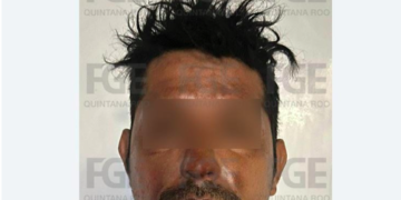 Detenido feminicida que le prendió fuego a su pareja