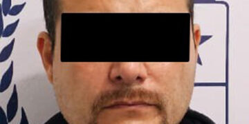 Detenido por causar lesiones a una mujer en una cirugía estética