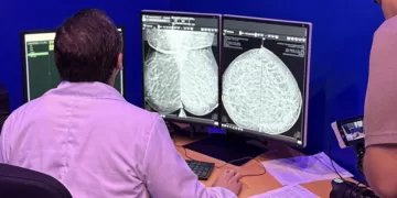 Q. Roo implementa Inteligencia Artificial para detección de cáncer de mama