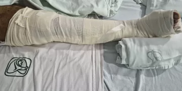 Chetumal.- Derechohabientes del Instituto Mexicano del Seguro Social (IMSS) en Chetumal denunciaron las pésimas condiciones en las cuales se encuentra la clínica, ya que pacientes de traumatología llevan más de tres semanas sin ser atendidos y pasando un calvario desde su ingreso a urgencias, hasta ahora que se encuentran en piso, sin que los encargados de la coordinación den informes o una solución, pues al parecer el médico traumatólogo que los atiende ha renunciado. Son al menos siete pacientes con fracturas en manos, brazos, fémur y tobillo, que llevan internados entre tres semanas, a mes y medio, sin que hasta el momento sean intervenidos quirúrgicamente por parte del traumatólogo Miguel Obeso Ancheita, pese a ser programados de manera semanal, pues este doctor solo está asignado a los fines de semana. Estos han pasado un calvario desde su ingreso a urgencias, hasta ahora que se encuentran en piso, sin que los encargados de la coordinación den una solución, informes o respuesta, pues al parecer el médico traumatólogo que los atiende ha renunciado pues no saben nada de él desde hace dos semanas, ya que no ha llegado a “visitar” a sus pacientes. “Ya llevo 26 días esperando una cirugía de muñeca. Primero estuve dos semanas en urgencias en unas condiciones pésimas; primero en una silla de ruedas, luego en una banca, luego en un reposet porque no tienen camillas y después de 15 días nos pasan a piso y nos traen a puras vueltas de que nos van a operar y nada. El sábado 7 me programaron pero nada, ya lleva dos semanas que no se presenta el doctor Obeso”, abundó uno de los pacientes. Además de la nula operación y sin respuesta a que sucederá, otra preocupación de las personas internadas es la generación de alguna infección ya que tienen heridas expuestas sin que haya médico tratante, e incluso algunos ya tienen enfermedades respiratorias sin medicamentos, ya que el personal de enfermería no les puede suministrar medicamentos sin autorización. “Mi hijo tiene fractura de fémur y tobillo, entonces la fémula ya tiene tiempo y no se la quieren cambiar porque tiene heridas expuestas que solo se las limpian, pero no pasa a más ya que él necesita operación”, comentó la madre de un paciente, que prefirieron no mencionar nombres por temor a que los dejen esperando más tiempo sin atención. Muchos de ellos no están canalizados, pues solo les aplican los medicamentos horas antes de que sean trasladados al quirófano, pero su sorpresa es que al llegar y luego de varias horas les dicen “que siempre no serán intervenidos porque no hay médico”. Los pacientes pidieron comprensión de los responsables de Coordinación del IMSS y se les asigne un médico especialista para poder brindarles la atención que requieren, pues muchos de ellos son padres de familia y con un trabajo que a pesar de tener incapacidad temen perderlo. Esto porque el personal de coordinación ya no se quiere hacer responsable ni dar atención a los familiares de los pacientes. “Fui hablar con el coordinador de nombre Lorenzo y se portó muy déspota, me dijo que si tengo que acudir a los medios lo haga, porque al final del día el trabaja por gusto y no por necesidad y si lo corren o no, no le afecta en nada. Pero aquí nos preocupa porque él no es quien está internado sin la atención”, aseguró otro de los afectos. Los pacientes reiteraron que desconocen que sucederá con sus casos, puesto que temen una lesión mayor con las fracturas que solo se encuentran vendadas o en otros casos expuestas por tener heridas abiertas. Por lo tanto hicieron un llamado al delegado del IMSS en Quintana Roo e incluso a la propia gobernadora del Estado, Mara Lezama para que sean asignados a otro médico traumatólogo, pues han escuchado casos que pueden tener un médico temporal para la atención de pacientes.