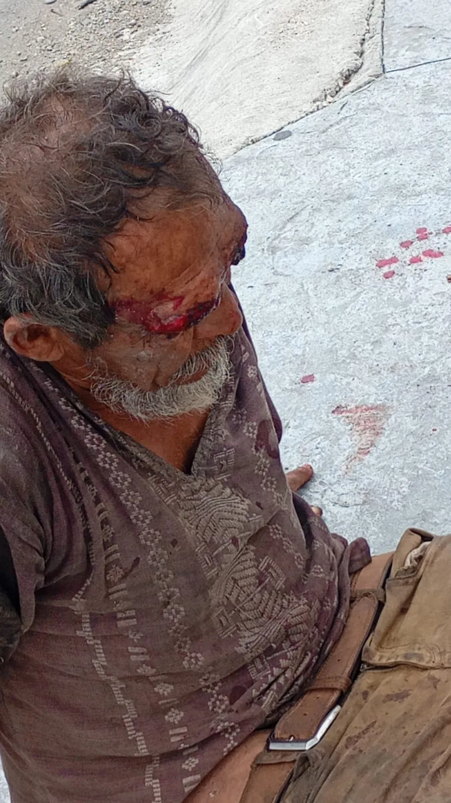 Localizan a hombre lesionado sobre la avenida Kabah; fue trasladado al Hospital General